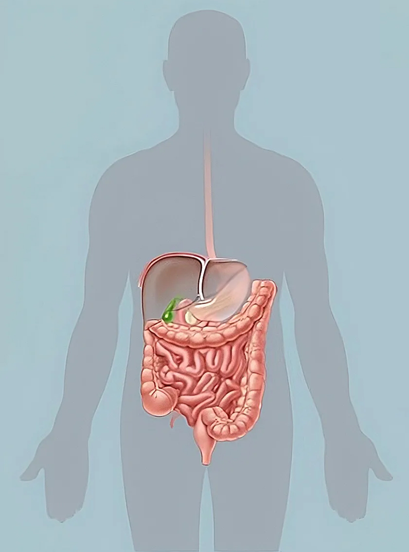 Mistletoe Therapy at IIIO