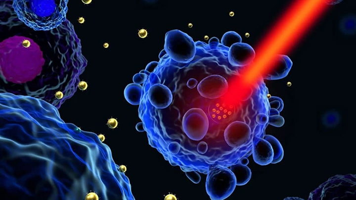 Indian Institute of Integrative Oncology